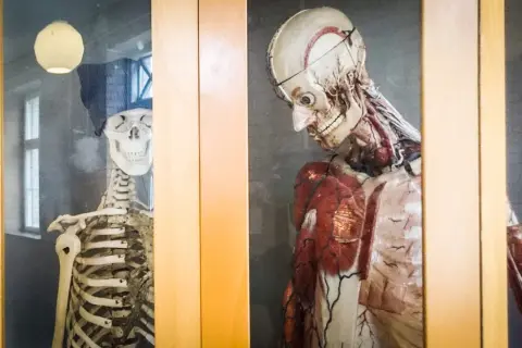 Två anatomiska modeller, en skelett med mössa och glasögon, och en muskelmodell, står bakom glas. Ett skelett i garderoben?